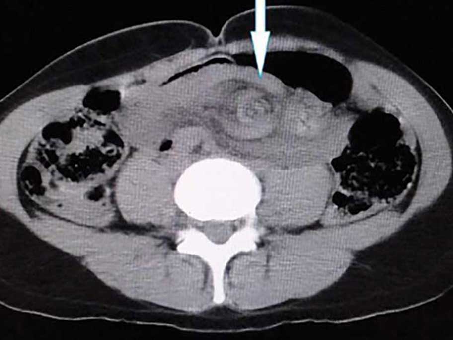 Constipation diagnosis takes a turn | AusDoc