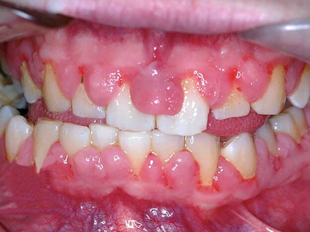 Spot Dx — Why are these gums giving grief?