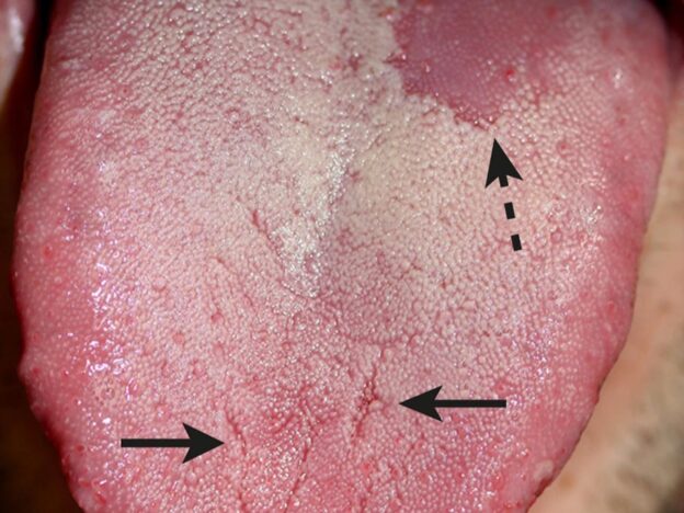 Spot Dx — Is the answer on the tip of the tongue?