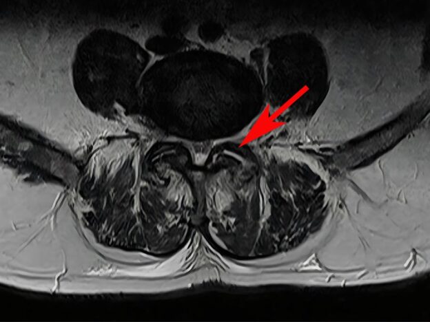 Medical Must-See: Suspected septic arthritis masks unique case of gout