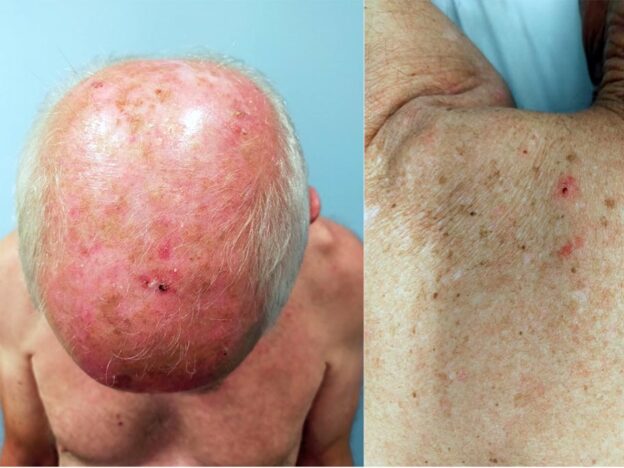 Spot Dx — What’s the cause of pruritus?