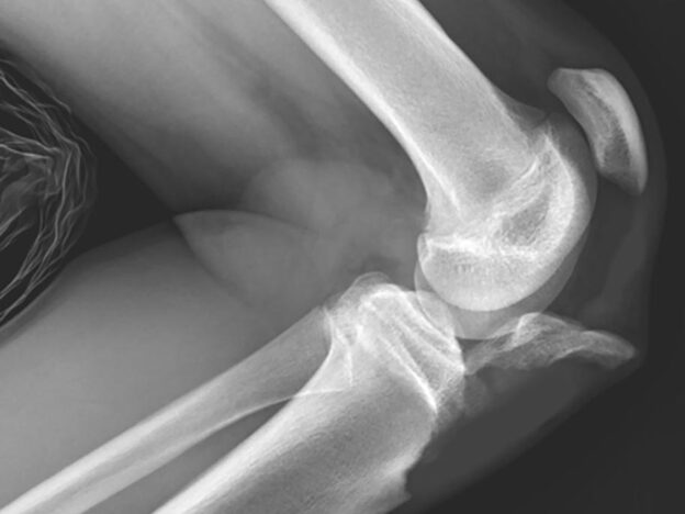 Spot Dx — What’s the cause of this knee pain?