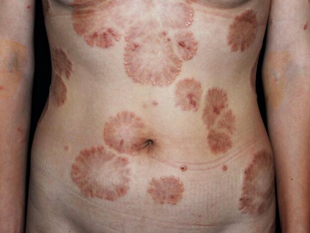 Spot Dx — Which condition rings true?