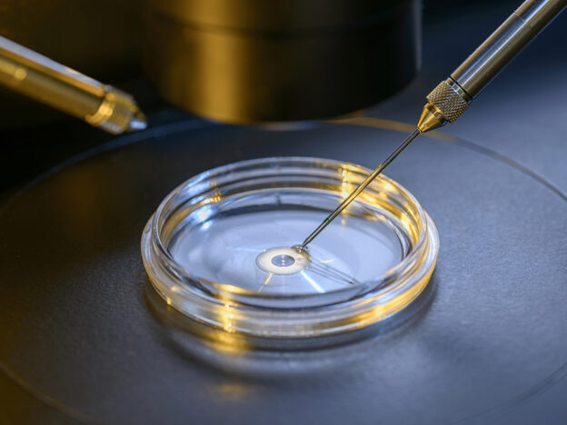 Isthmocele, not prior C-section, lowers IVF success rate: study