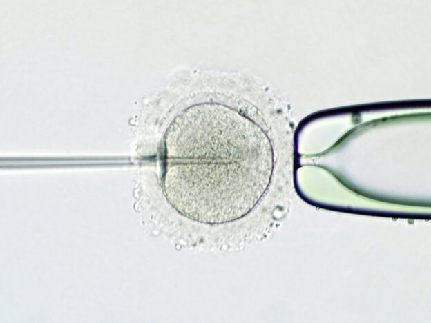 Intracytoplasmic sperm injection does not help increase live births