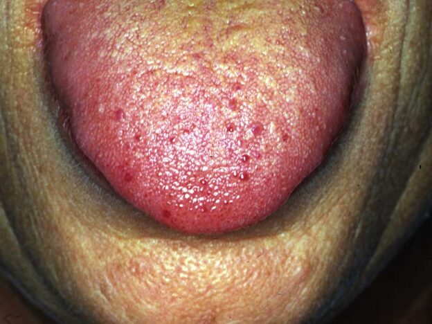 Spot Dx — Is the answer on the tip of his tongue?