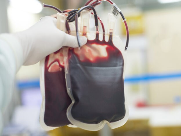 90 blood transfusions fail to avert autoimmune anaemia in rare case