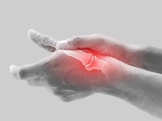 A GP guide to hand osteoarthritis