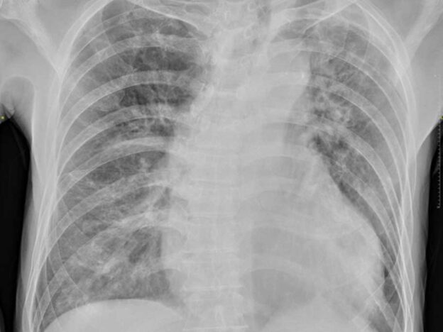 Spot Dx — What's the cause of this blackout?