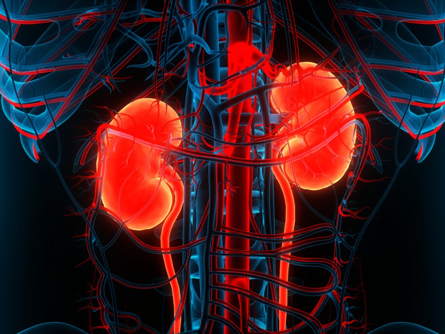 Acute kidney injury linked to increased risk of dementia | AusDoc