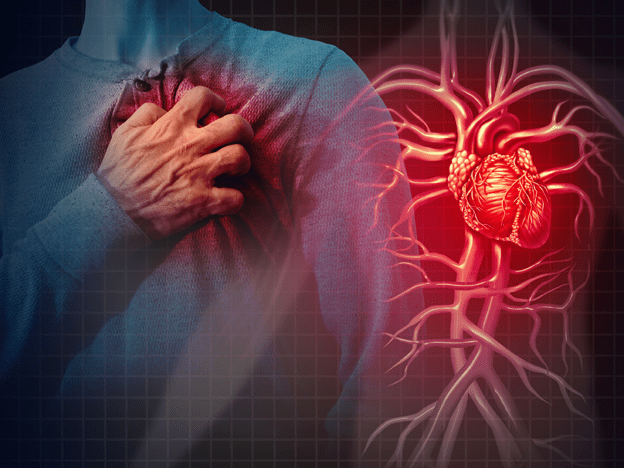 A GP guide to colchicine in coronary artery disease