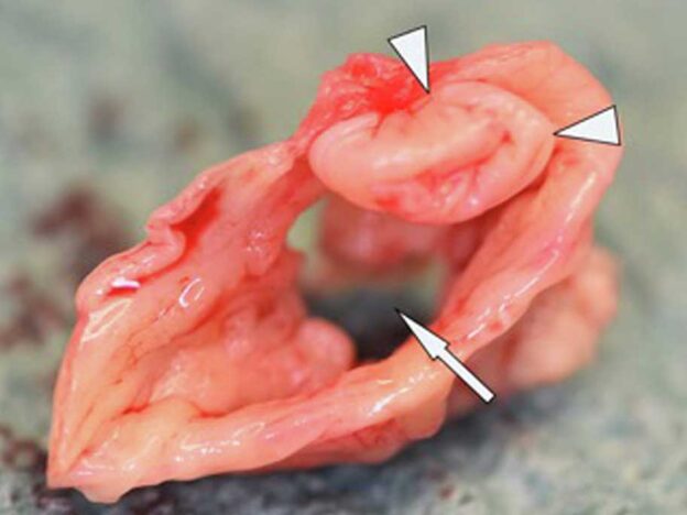 Medical Must-See: Unusual housemate leads to infection and aortic valve replacement