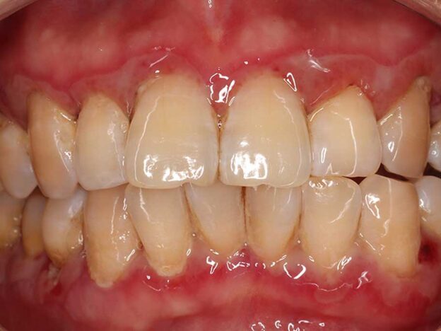 Spot Dx — Puzzling mouth pain gets worse