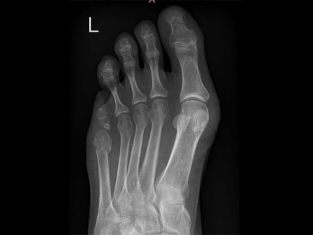 Spot Dx — What's behind this swollen foot?