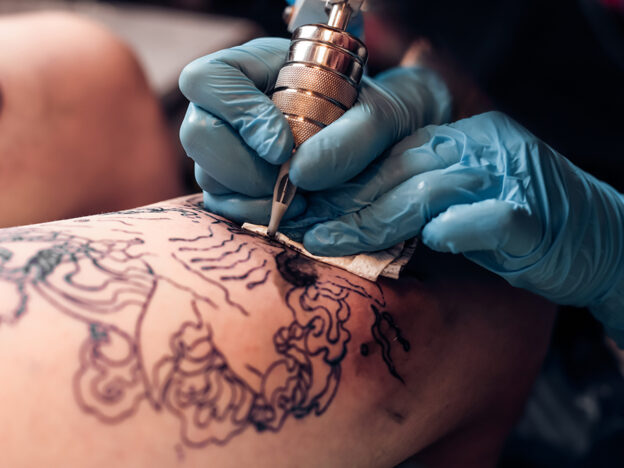 Fresh tattoos may have caused keratoacanthomas in two patients: case report