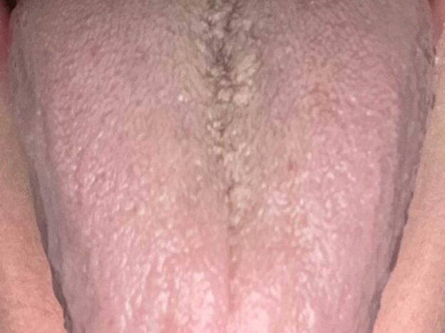 Spot Dx — Is the answer on the tip of the tongue?